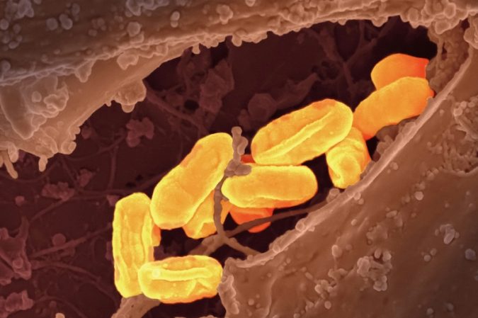 national institute of allergy and infectious diseases tjTKY kz gg unsplash